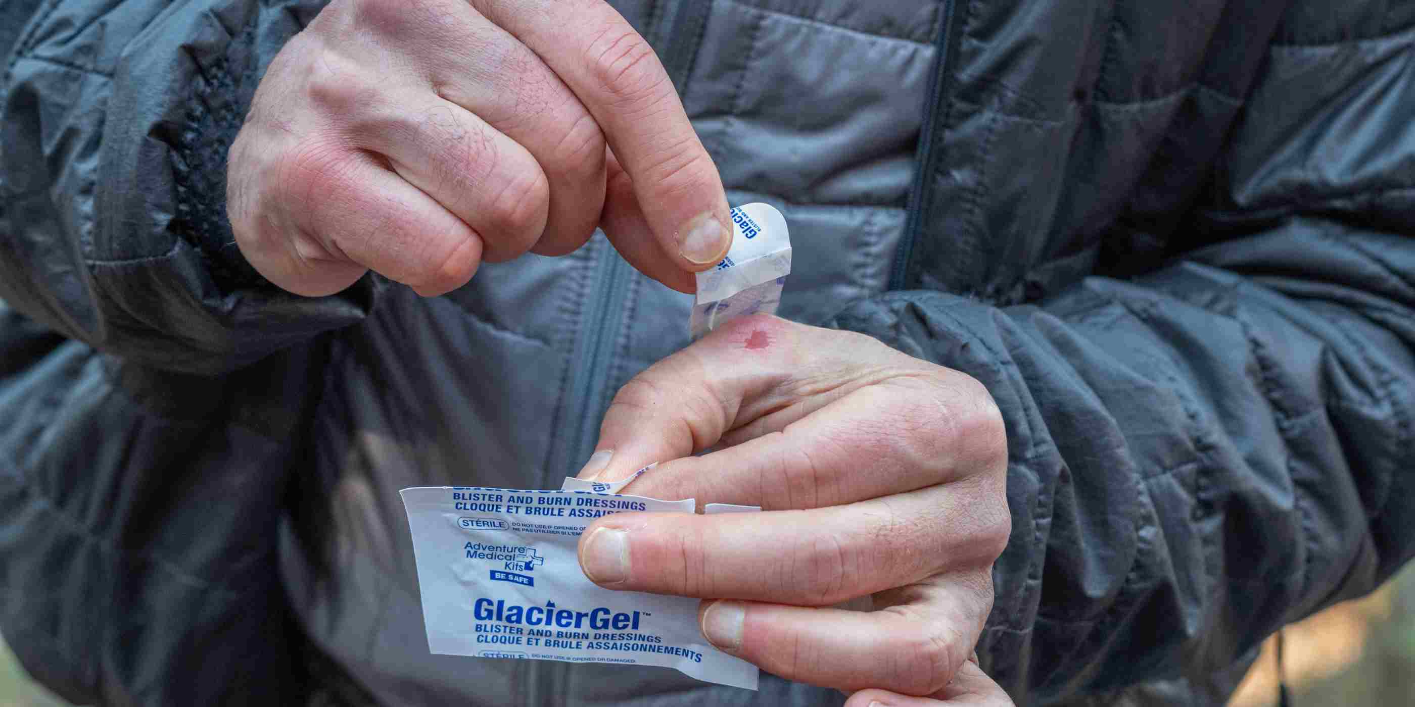 GlacierGel Blister and Burn Dressing applying to a blister on a hand