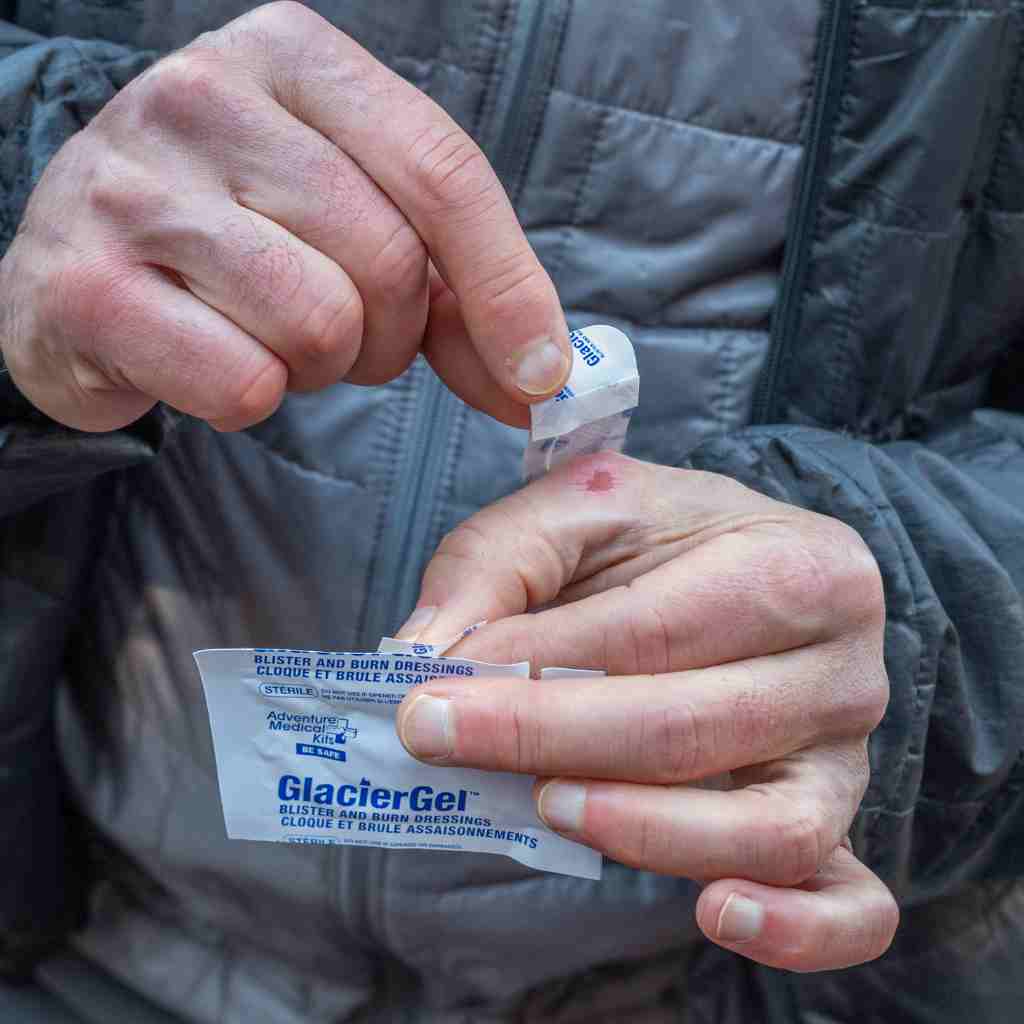 GlacierGel Blister and Burn Dressing applying to a blister on a hand
