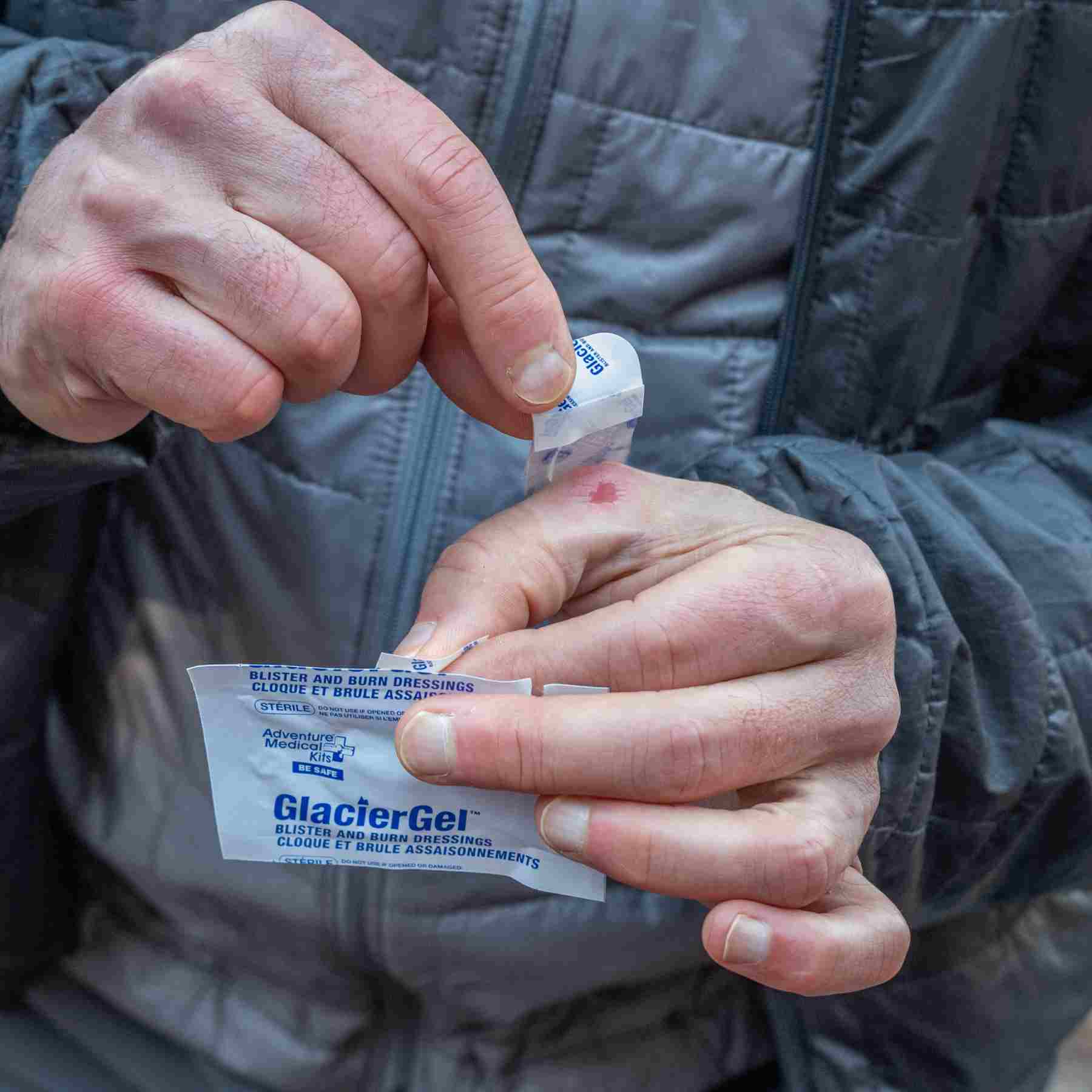 GlacierGel Blister and Burn Dressing applying to a blister on a hand
